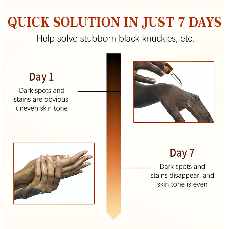 Drak knuckles whitening serum