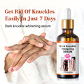 Drak knuckles whitening serum